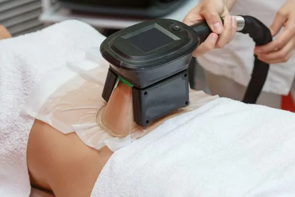 Image of person having fat freezing treatment to help weight gain Earley