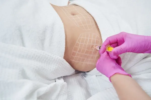 image of fat dissolving injections on love handles to help combat weight gain Earley