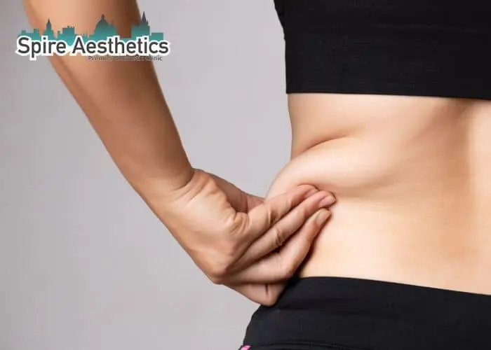Image of woman pinching fat on their hips Earley. Fat Freezing treatment