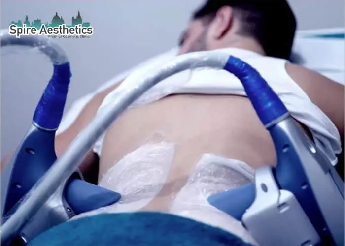 Man having fat freezing treatment done on love handles before a competitions Earley to create a sculpted look.