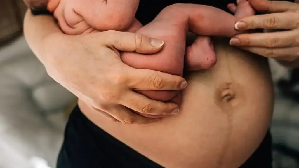 Why Is My Stomach Still Big After Pregnancy Earley?